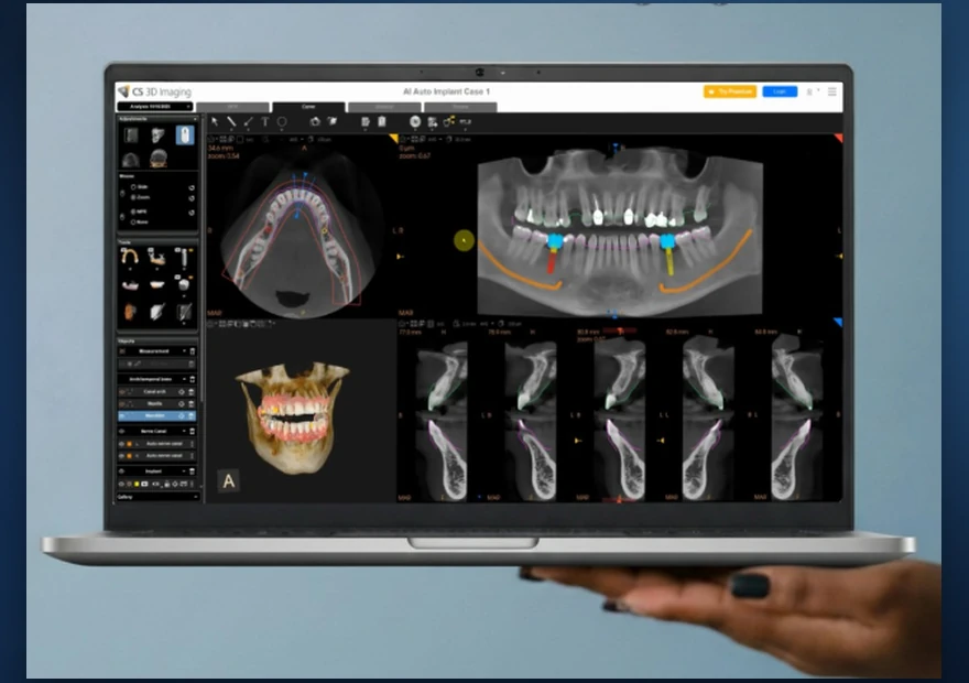 Imagem DICOM aberta em software clínico