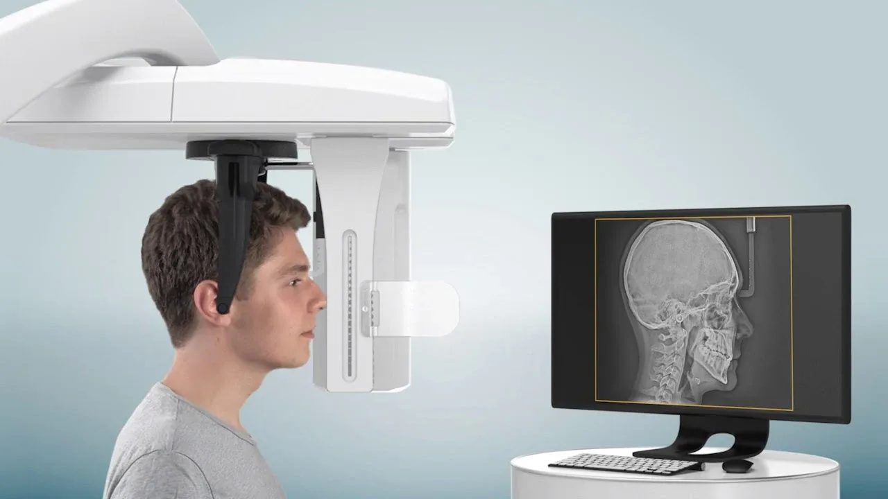 Telerradiografia de Perfil