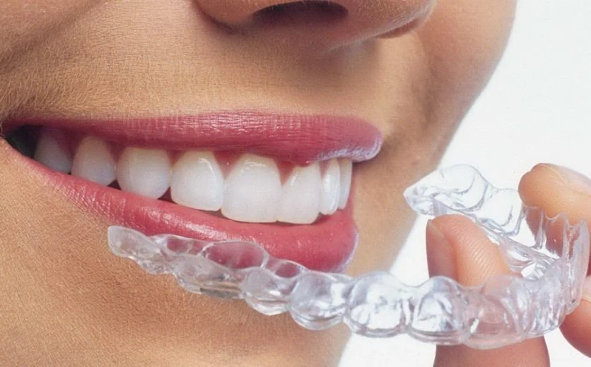 Sorriso com estética dentária